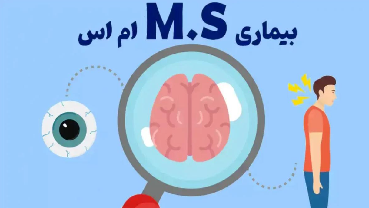 علت بوجود آمدن بیماری ام اس چیست