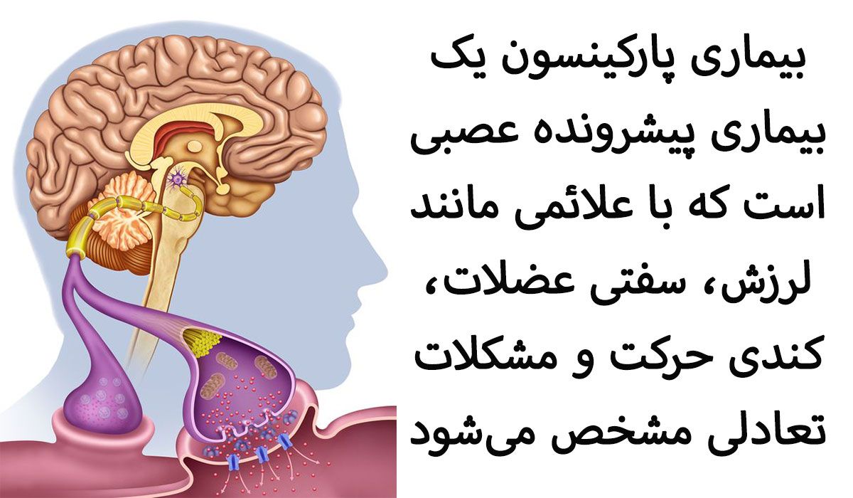 مصرف پروبیوتیک ها و پارکینسون
