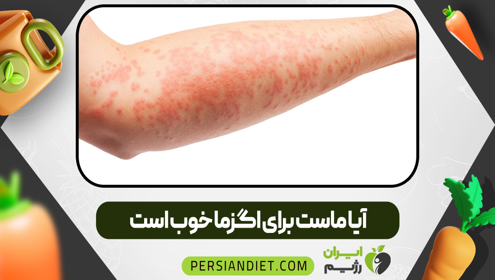 آیا ماست برای اگزما خوب است