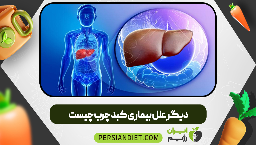 دیگر علل بیماری کبد چرب چیست | ایران رژیم دیگر علل بیماری کبد چرب چیست