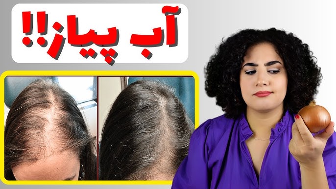 راه‌های تقویت پوست و مو