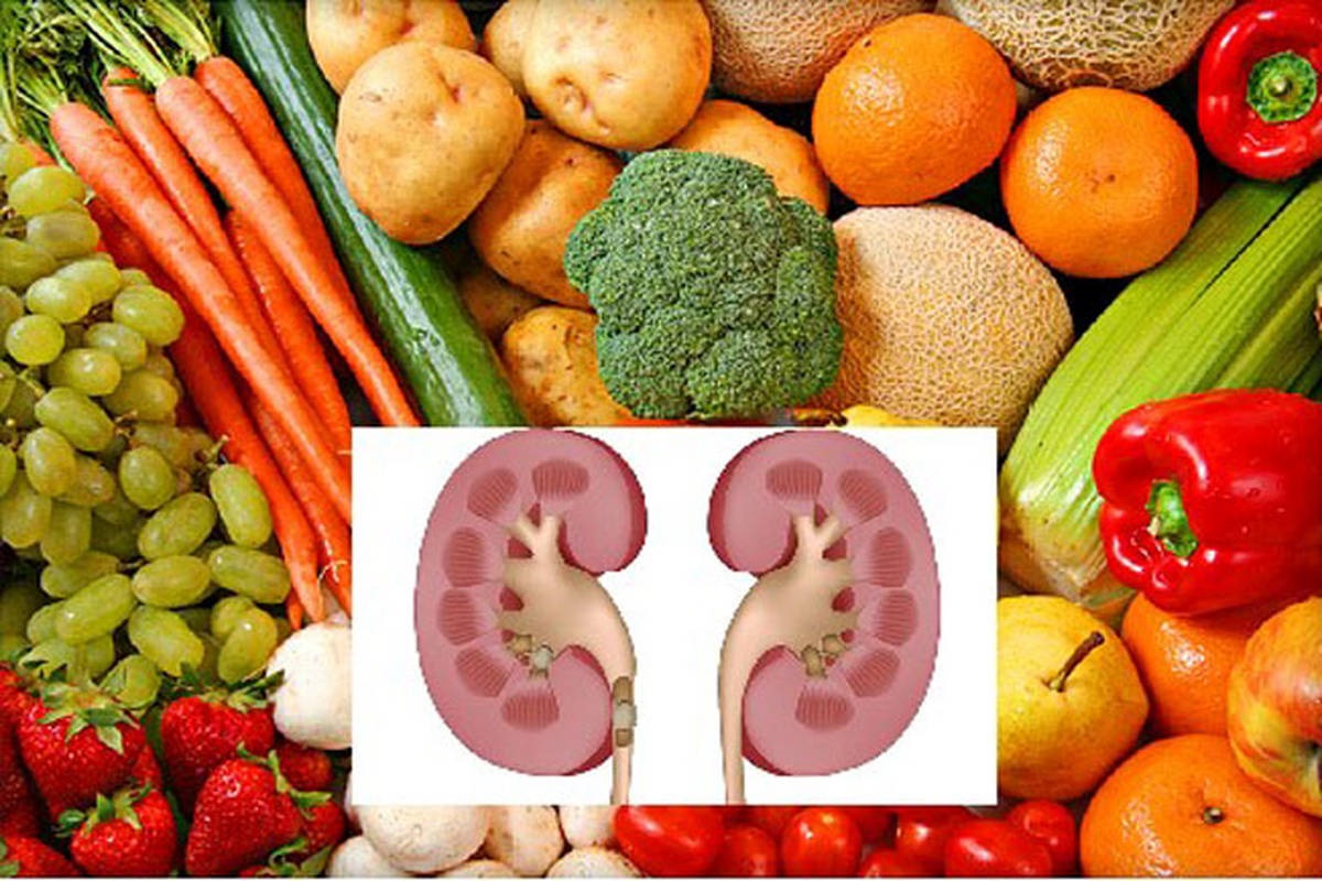 برنامه غذایی پیوند کلیه