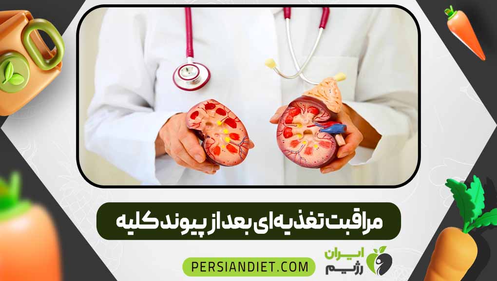 مراقبت تغذیه‌ای بعد از پیوند کلیه